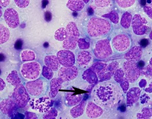 Gao-Gao-Tumor-Mitotic-Figure-arrow-300x235