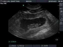 panda_ultrasound_lunlun_ZA_10-21-2010